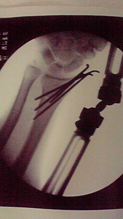2010021106380000.jpg